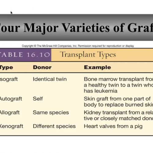 Organ transplant and age-related changes in the lymphatic and immune system